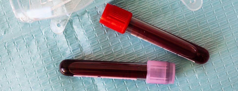 blood test tubes
